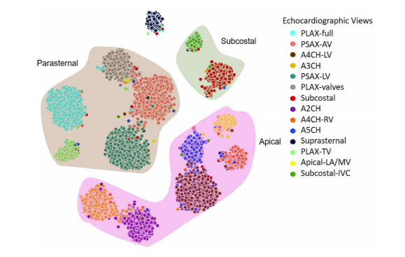 view classification